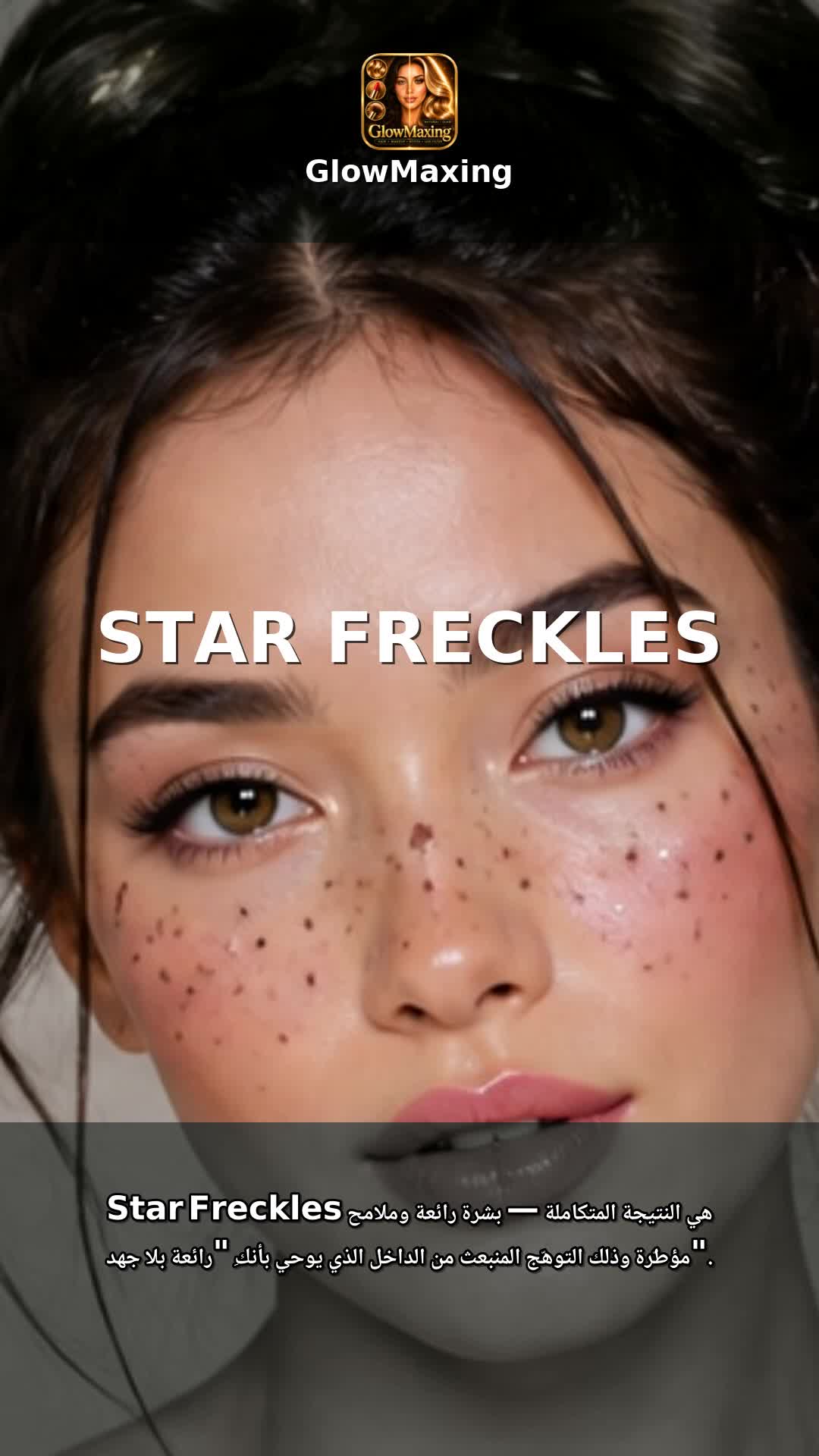 Star Freckles
