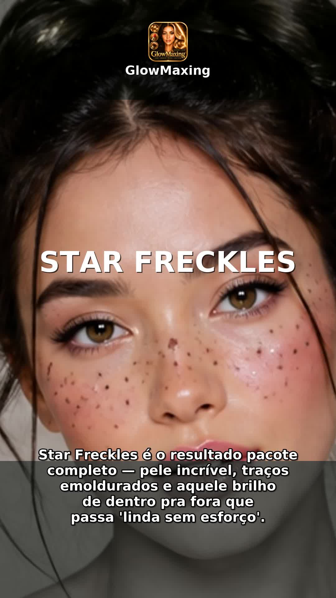 Star Freckles