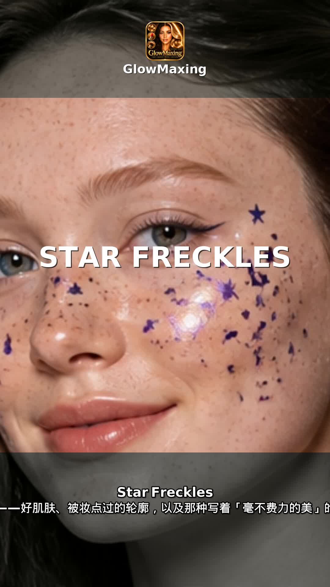 Star Freckles
